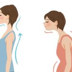 姿勢改善で売上UP！？風俗嬢のための美容整体と保険適用のリアル